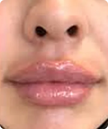 1504 2 3